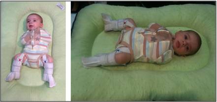 Woombie Convertible Onesie Woombie - Newborn 0-3M/2.5-6KG